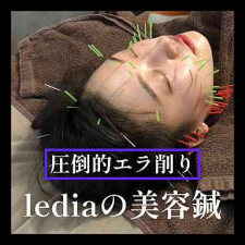 美容鍼　ledia（ルディア）堂島店