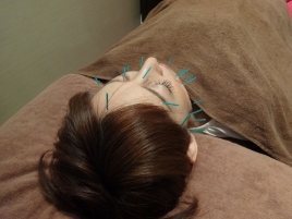 ルマ・リブール鍼灸治療院 美容鍼（顔のみ） のメニュー画像