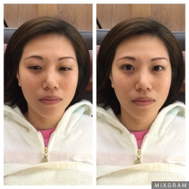 oosawa鍼灸整骨院 美容鍼のメニュー画像
