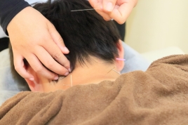 鍼灸サロンKEYAKI　～美容鍼・鍼灸・整体～ 鍼灸（局所）のメニュー画像