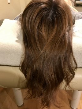 浮鍼®大学堂鍼灸院 美髪的鍼（2回目以降通常5500円）のメニュー画像