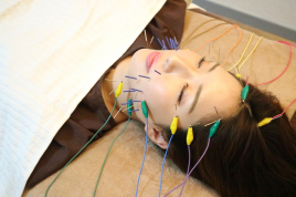鍼灸サロンmimosa 電気を流す美容鍼のメニュー画像