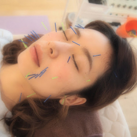 はりきゅうkokua 美容鍼のメニュー画像