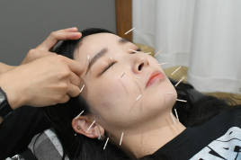 TOMO整骨院 美容鍼灸コースのメニュー画像
