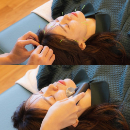 鍼灸サロンemma (エマ) たるみ・くすみ改善コースのメニュー画像