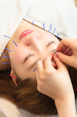 女性のための鍼灸サロンtete トライアル美容鍼(クーポンメニュー)のメニュー画像