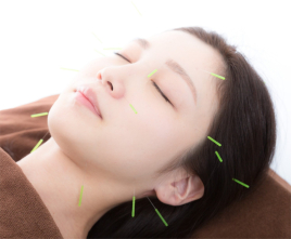 HIRO鍼灸治療院 美容鍼+全身ケア<人気コース＞のメニュー画像