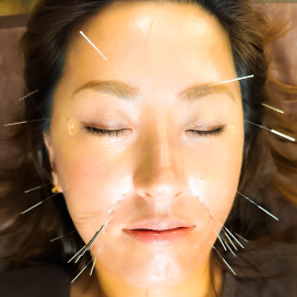 「おでかけ」のための鍼灸サロン　mata-tabi 優しい刺激の美容鍼／初回のメニュー画像