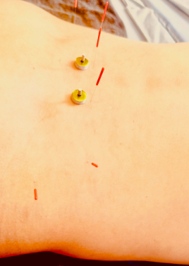 「おでかけ」のための鍼灸サロン　mata-tabi 全身鍼灸／しっかり腰周りケアのメニュー画像