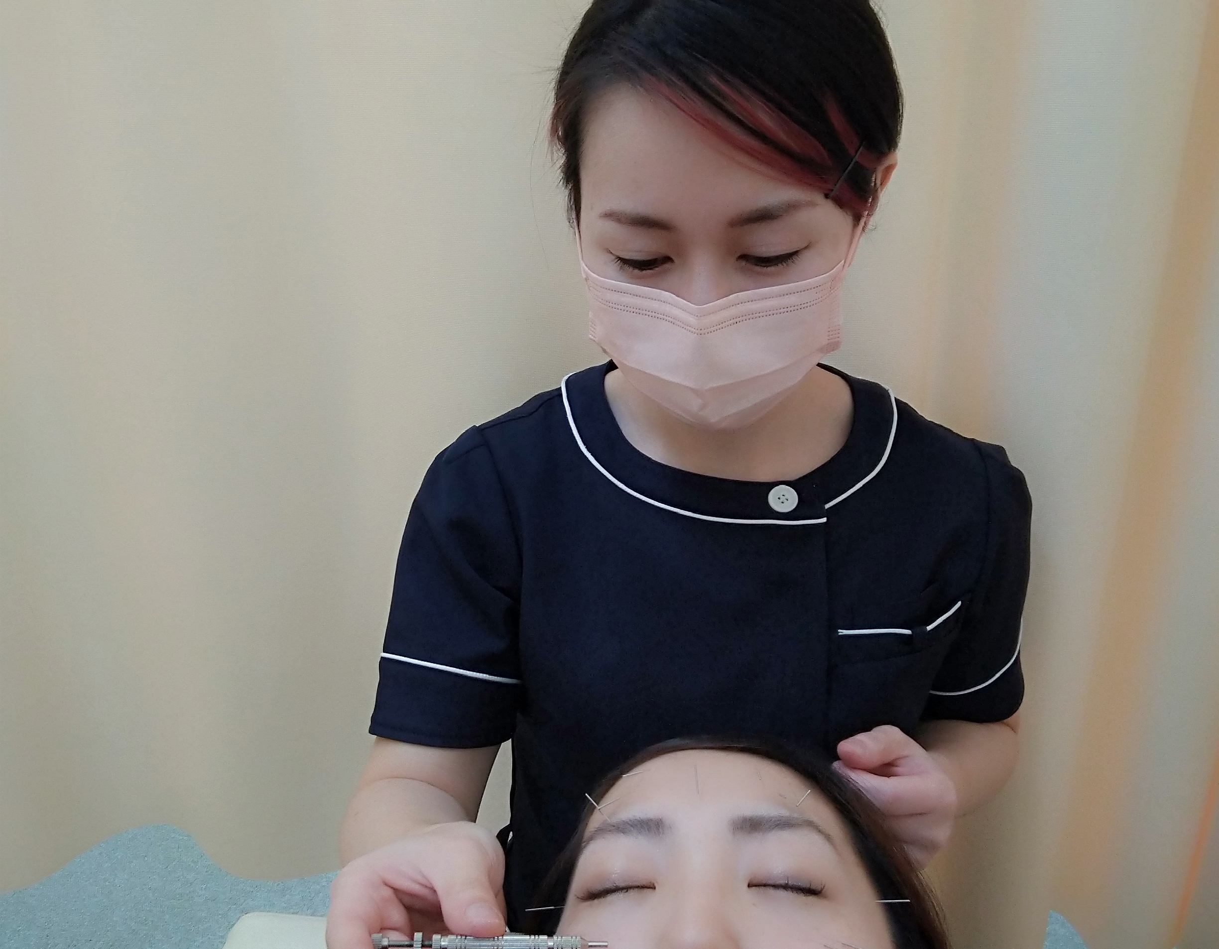 琴似女性の治療院(琴似中央接骨院) 美容鍼の回数券利用のメニュー画像