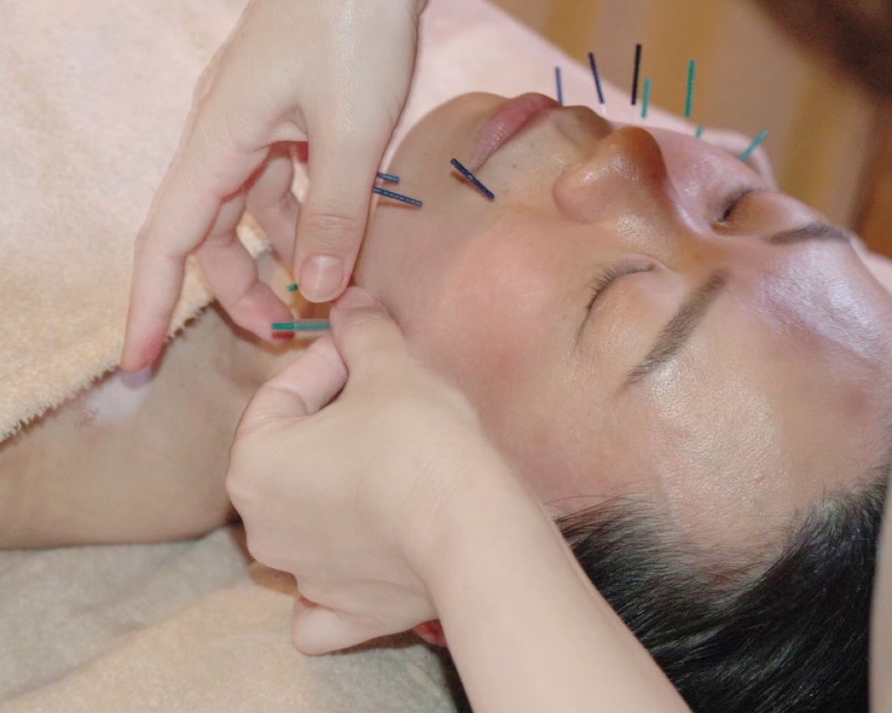 はりきゅう院mashiro オーダーメイド美容鍼灸のメニュー画像