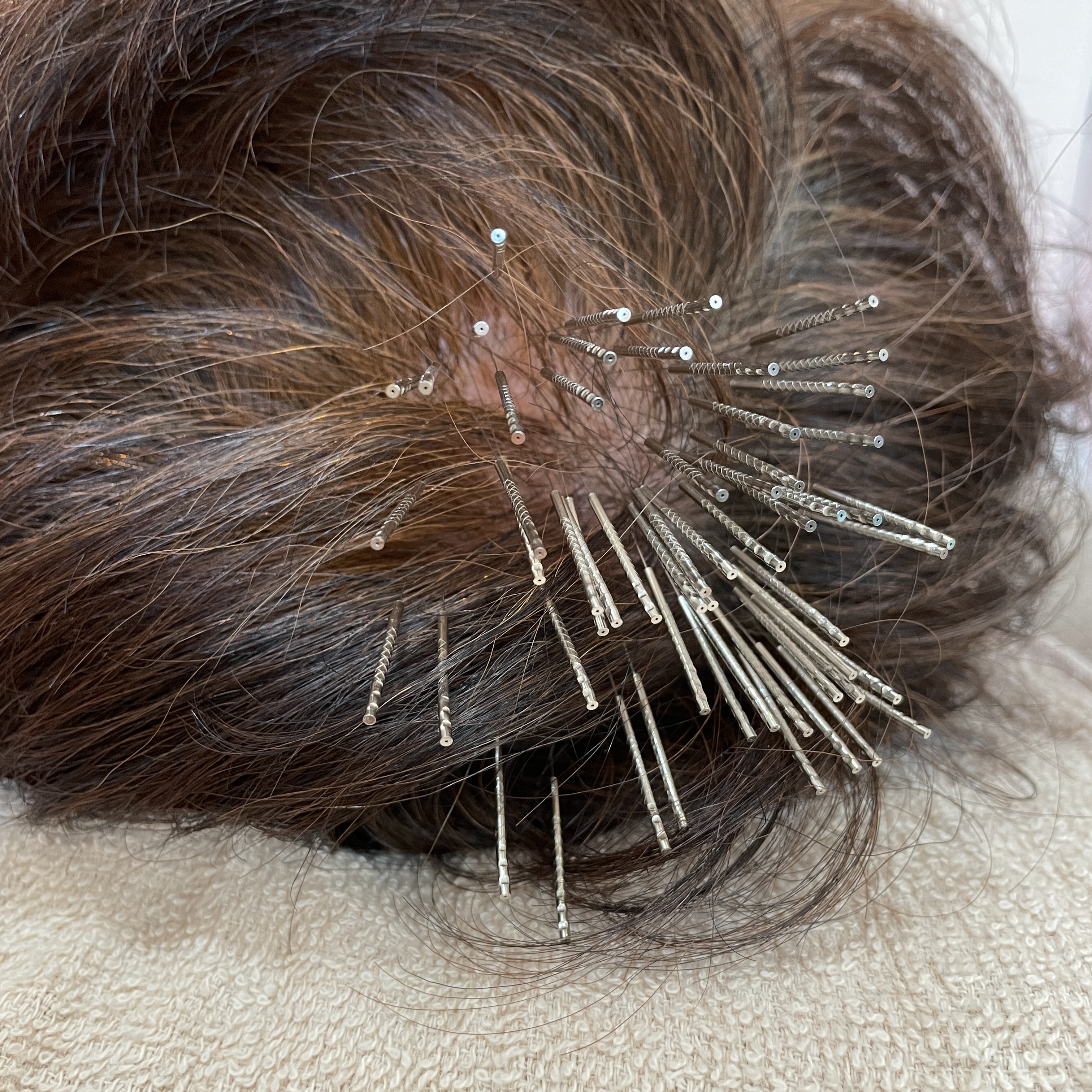 女性専門きよもと鍼灸院 幹細胞再生育毛鍼治療コースのメニュー画像