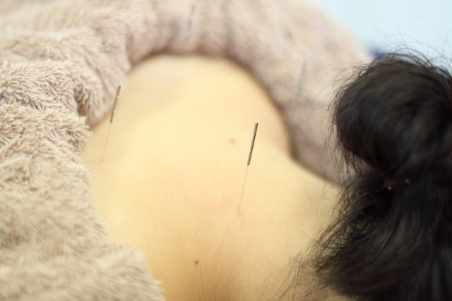 鍼灸Mea Nui 【お身体】鍼灸+整体30分のメニュー画像