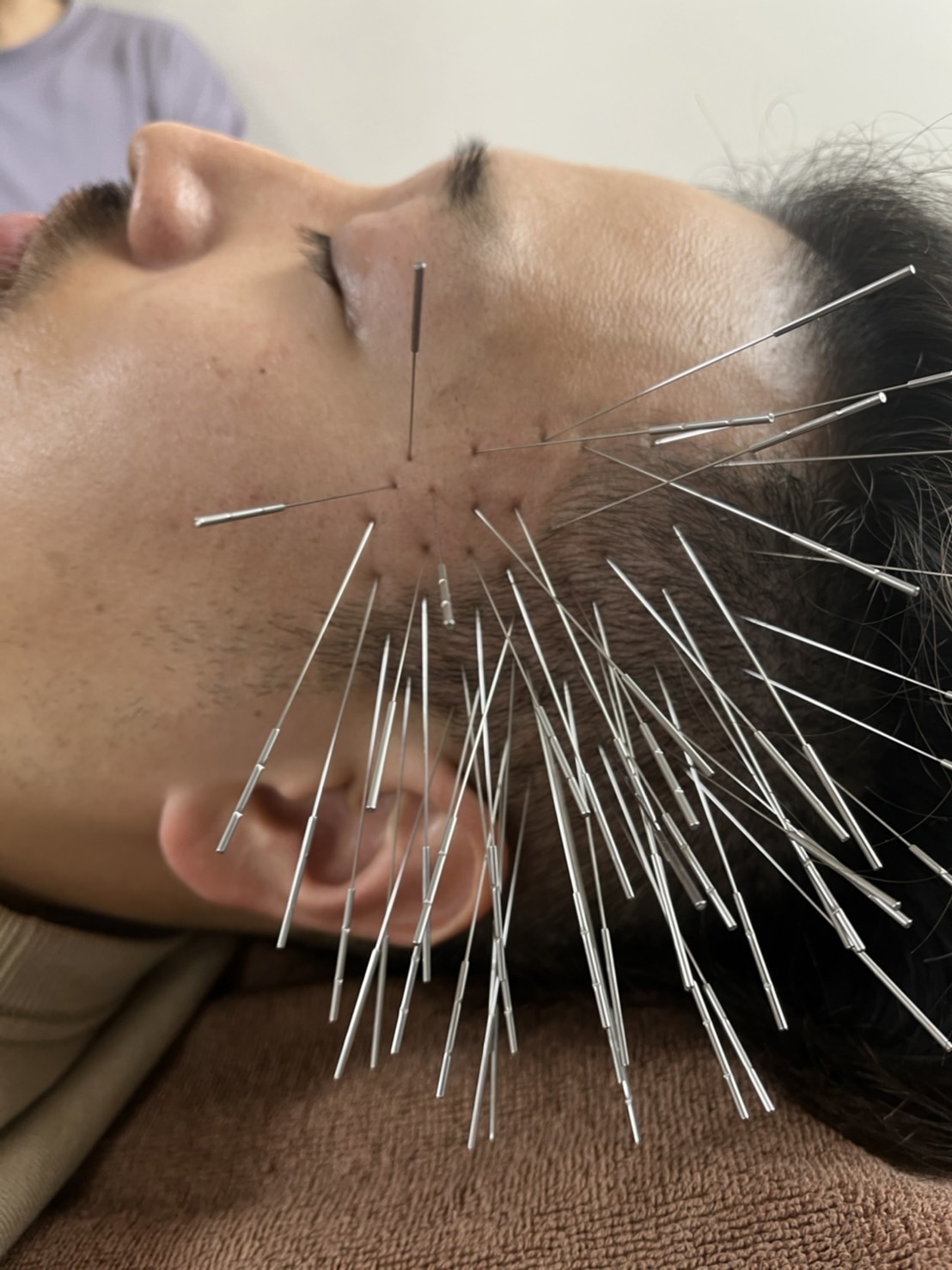 鍼灸サロンAy's ルート治療30分のメニュー画像