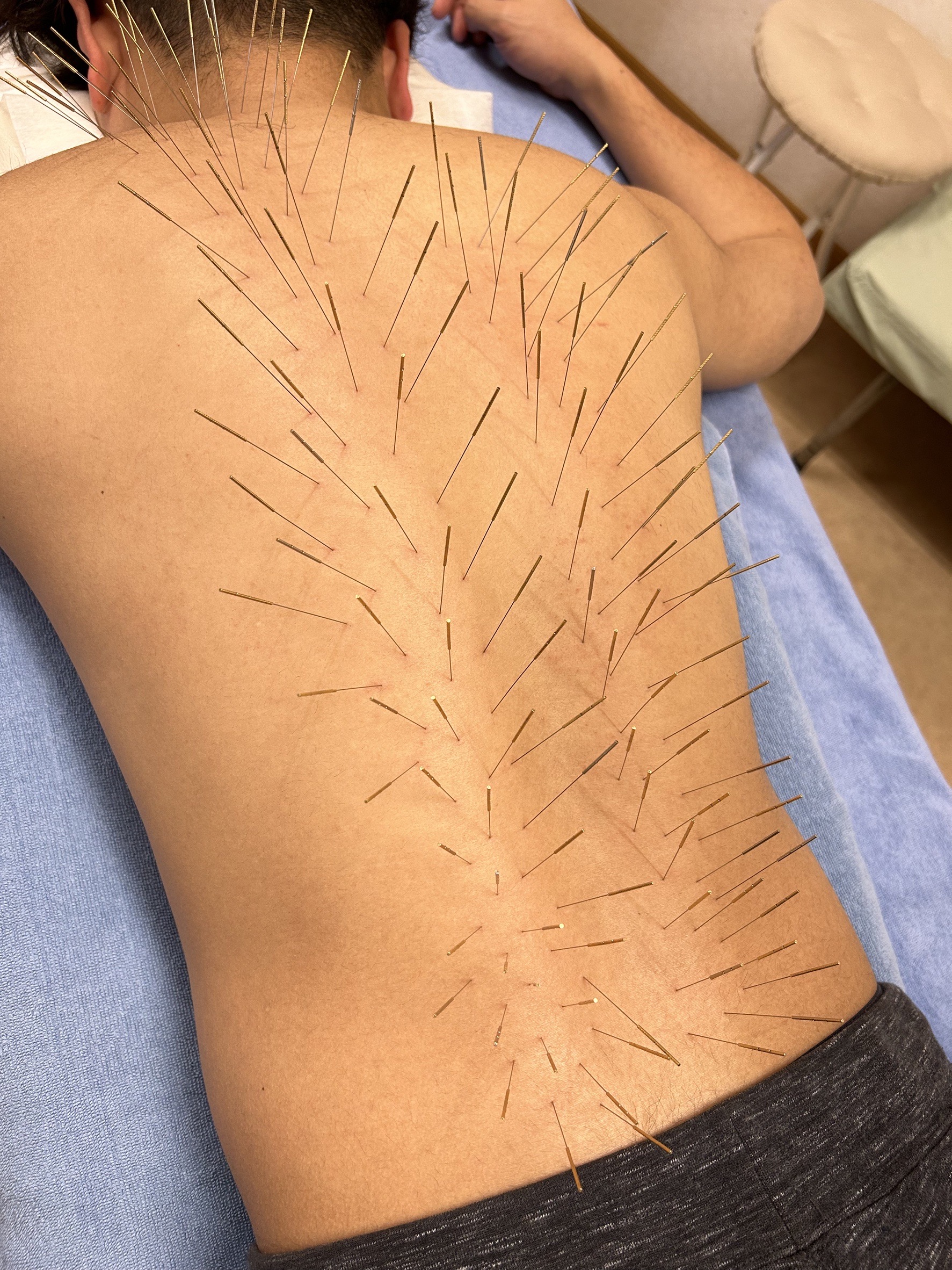 鍼灸サロンAy's ルート治療60分のメニュー画像
