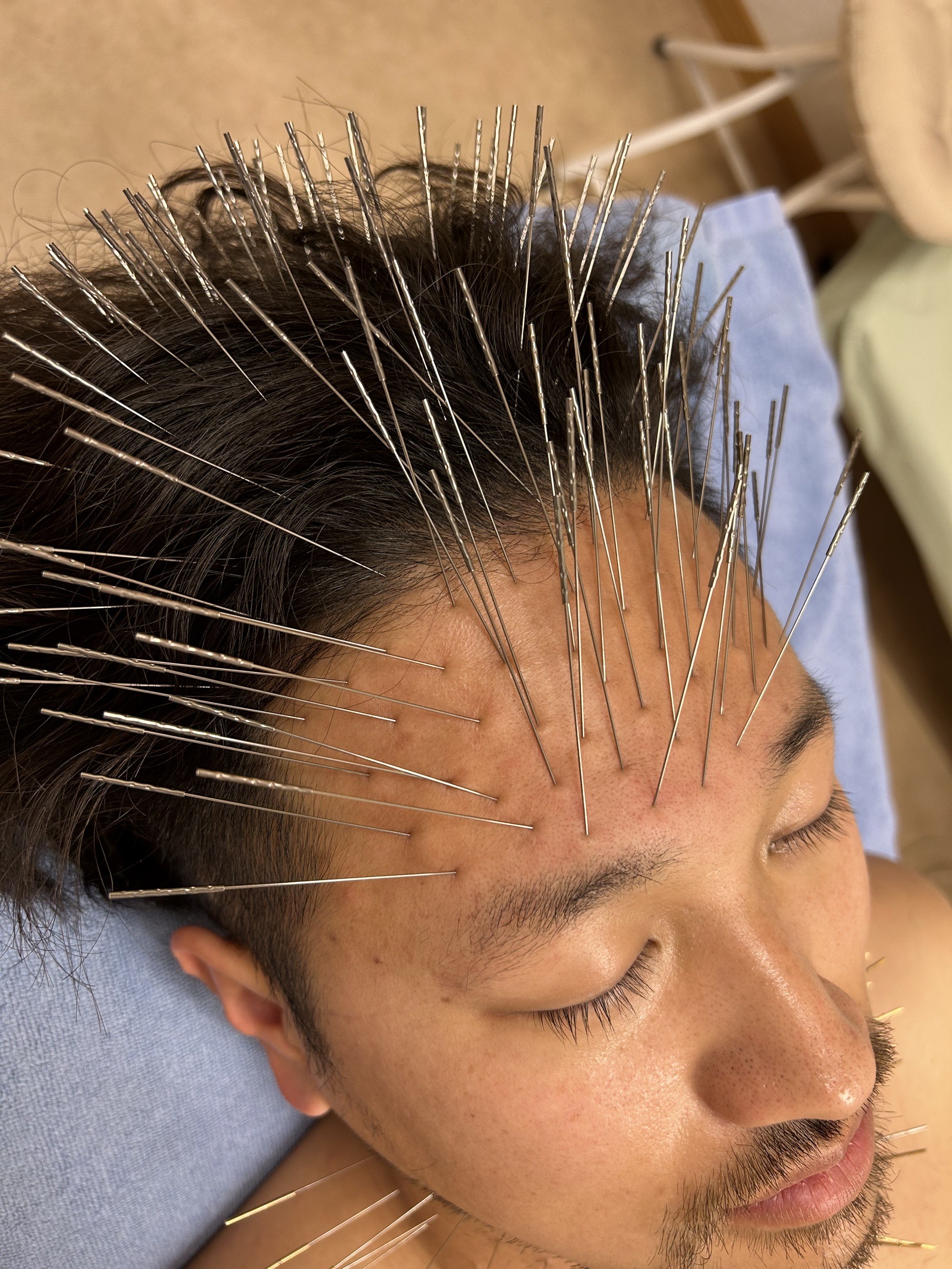 鍼灸サロンAy's ルート治療90分のメニュー画像