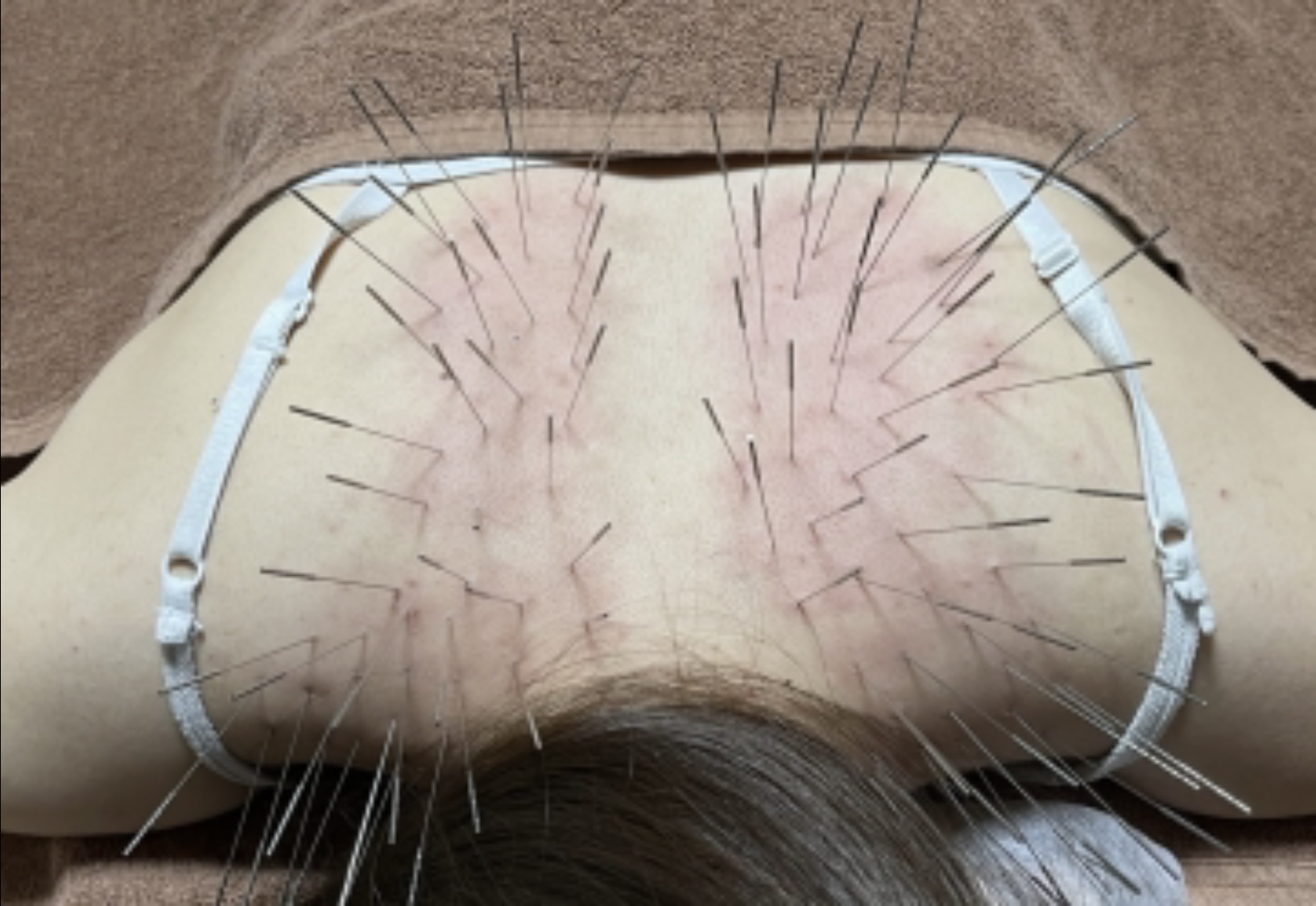 鍼と灸サロンクレド【ルート治療院】 ルート治療90分のメニュー画像