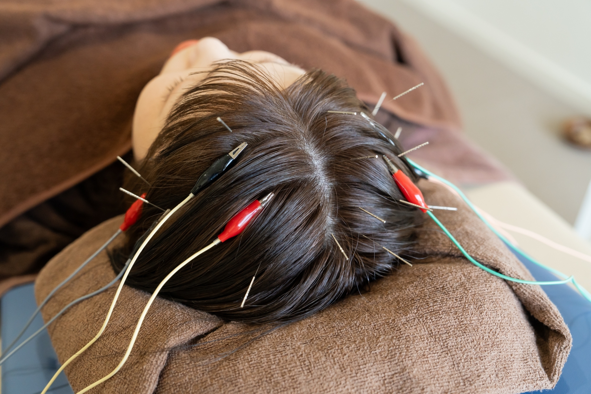 鍼灸整体サロンugi− 【目や頭の疲れ/頭痛/睡眠の悩みに】鍼を使ったヘッド施術（70分）のメニュー画像