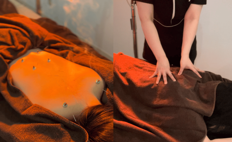 鍼灸サロン紅葉-MOMIJI- 一般治療　鍼灸マッサージ（部分）のメニュー画像