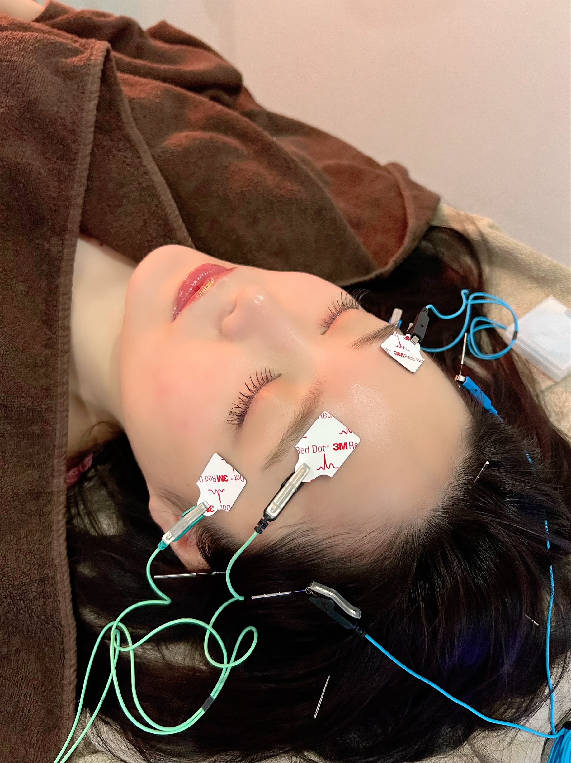 鍼灸サロン紅葉-MOMIJI- 自律神経調整鍼（ショート）のメニュー画像