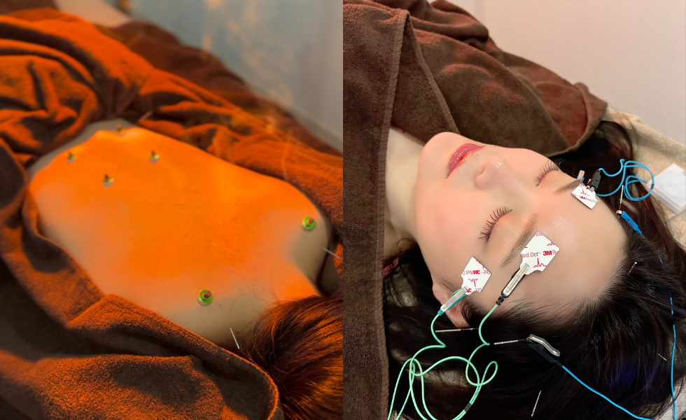 鍼灸サロン紅葉-MOMIJI- 自律神経調整鍼灸（ロング）のメニュー画像