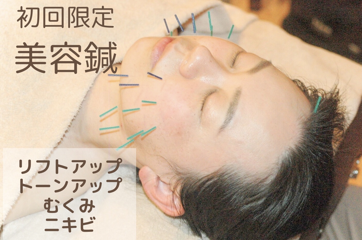 はりきゅう院mashiro 【初回限定】美容鍼灸-トライアルコース-のメニュー画像