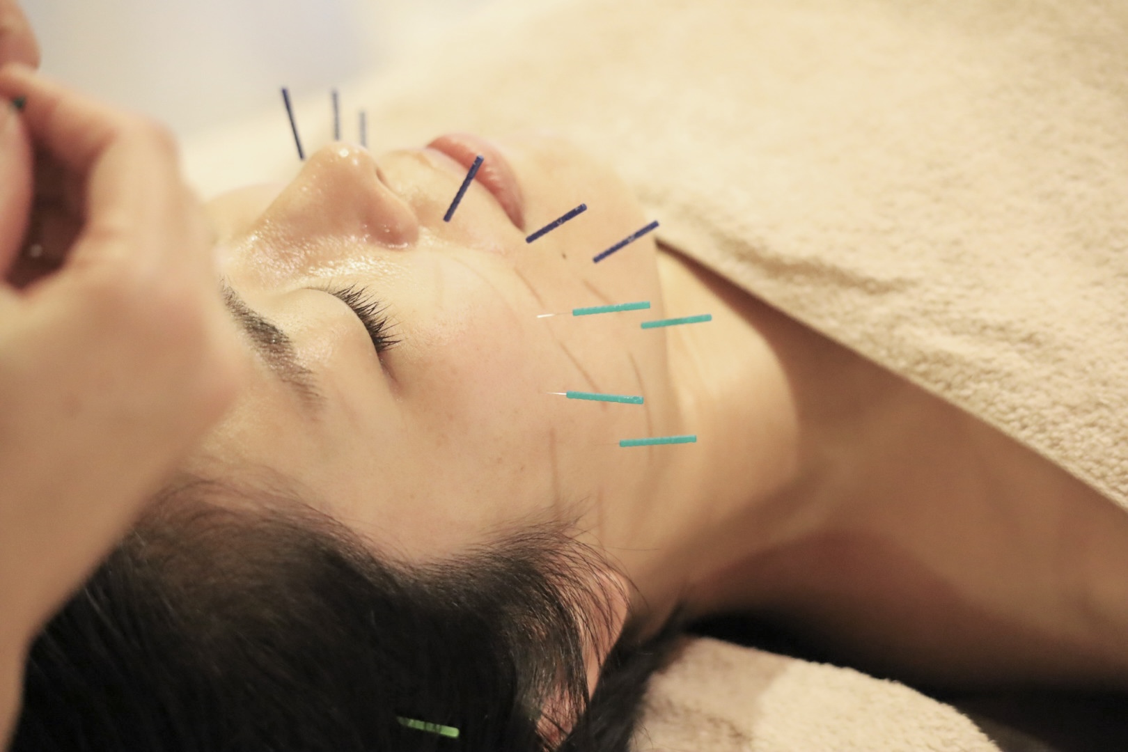 はりきゅう院mashiro 美容鍼灸-スタンダードコース-のメニュー画像