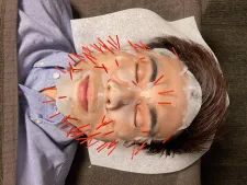 鍼灸整骨サクラノツバサ
