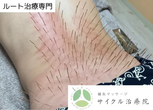 鍼灸マッサージ サイクル治療院 院詳細 | 練馬・江古田・田無の鍼灸院
