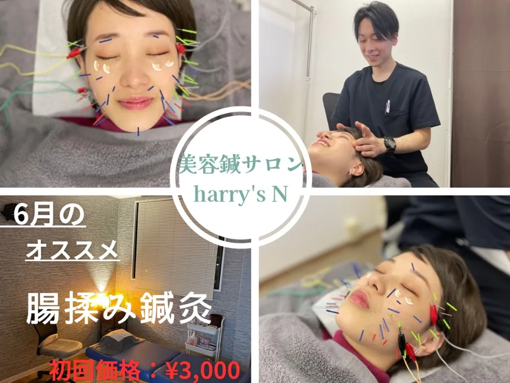 美容鍼サロン harry's N