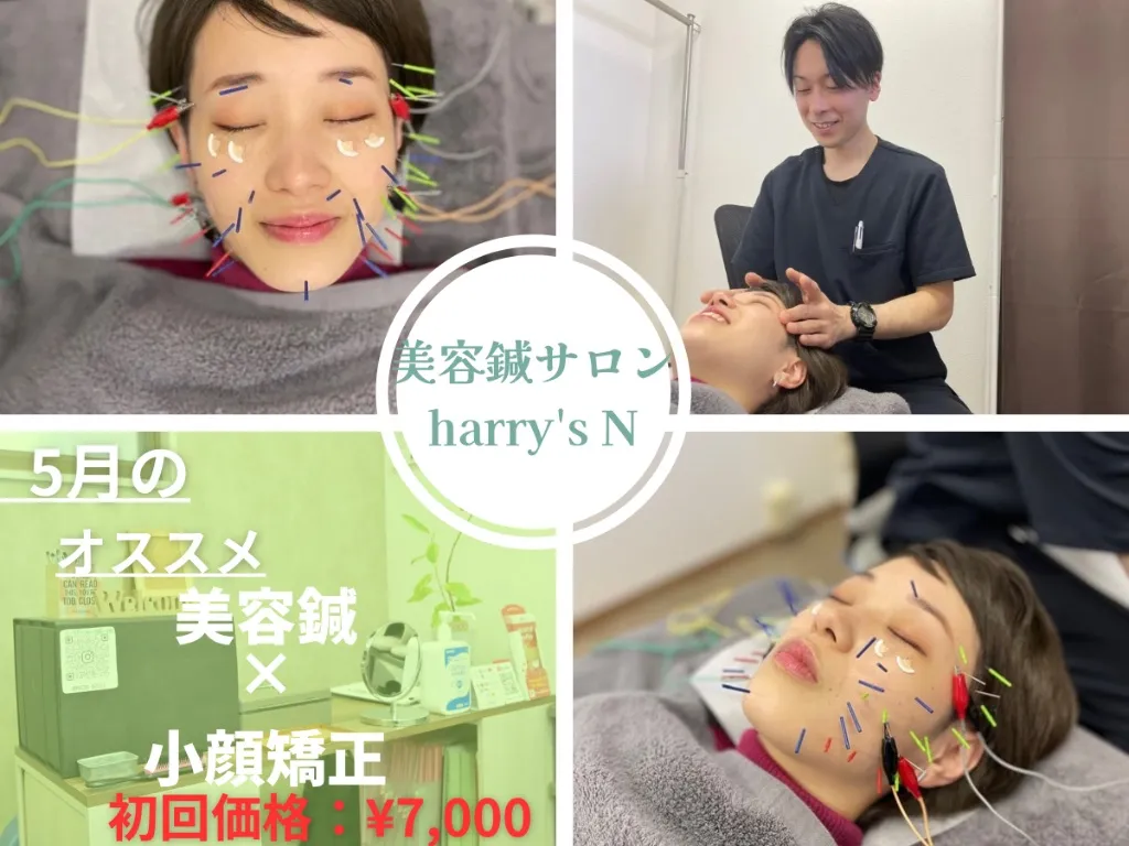 美容鍼サロン harry's N