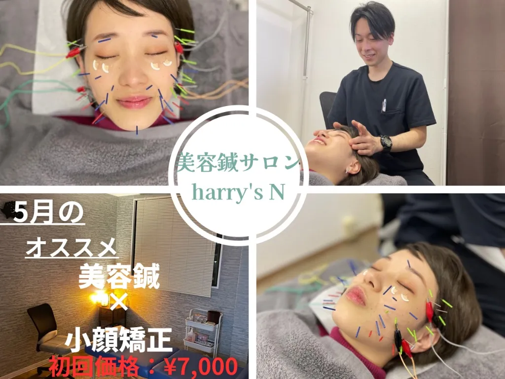 美容鍼サロン harry's N