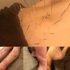 Iris鍼灸マッサージ上野院【ルート治療専門】