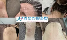 Angeあゆむ鍼灸院
