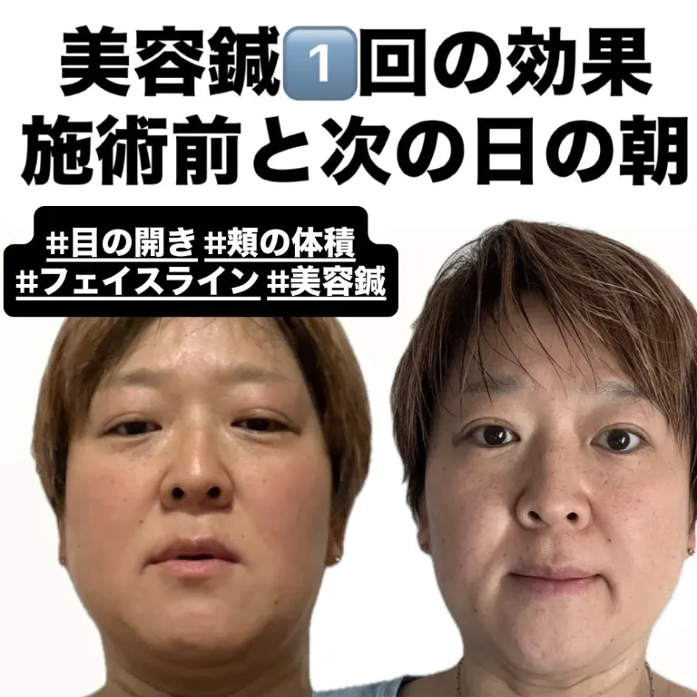 白山らくだ美容鍼灸整体院西巣鴨店~ 土・祝日営業 ~ 池袋駅板橋駅巣鴨駅から徒歩圏内
