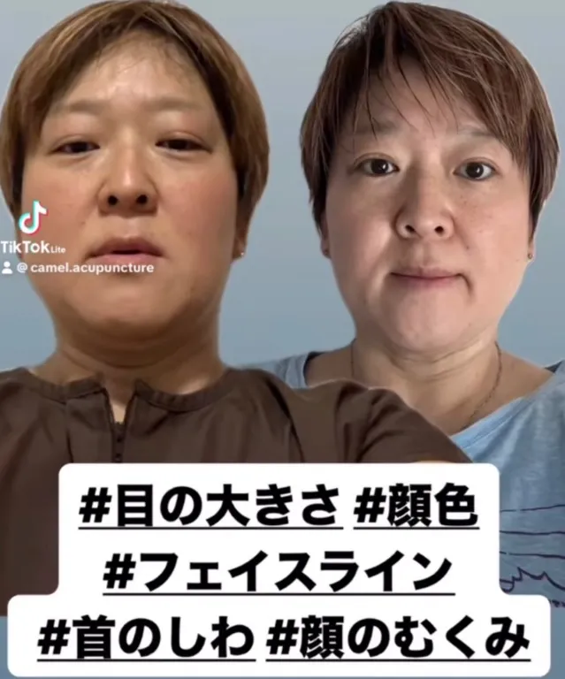 白山らくだ美容鍼灸整体院西巣鴨店~ 土・祝日営業 ~ 池袋駅板橋駅巣鴨駅から徒歩圏内