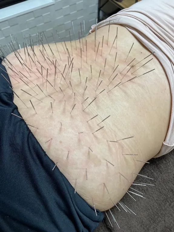 鍼打人 Aomori ルート治療 院詳細 | 青森・東津軽・八甲田山の鍼灸院