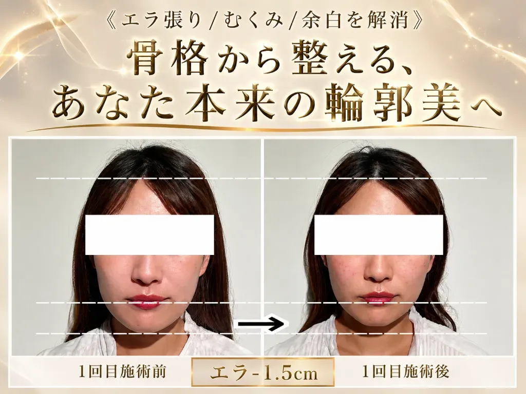 小顔矯正・美容鍼灸salon Yusaku 院詳細 | 本町・船場の鍼灸院・美容鍼