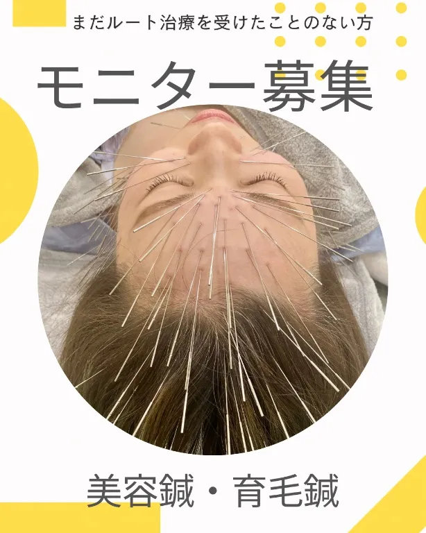 鍼灸院ハレ 岐阜ルート治療