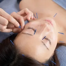 小顔美容鍼灸サロン 410 シトー