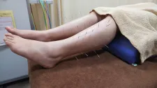 【慢性腰痛専門治療】宮代リリーフ鍼灸院