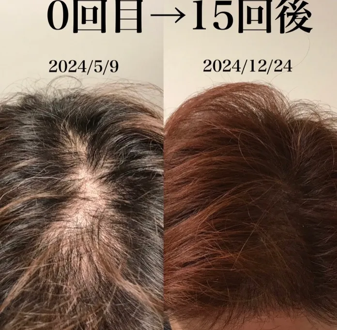 中野区野方鍼灸院のむち鍼 院詳細 | 練馬・江古田・田無の鍼灸院・美容