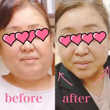 つばき美容鍼灸サロン