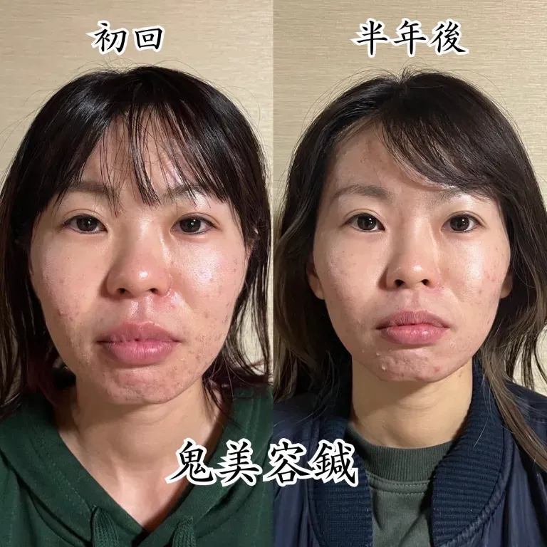 鍼処 紡ぐ