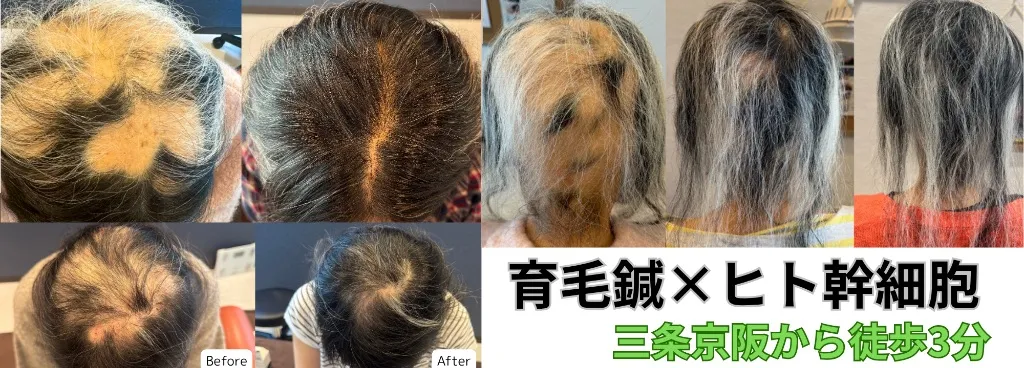 樹はりきゅう・整体院