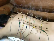 西谷鍼灸院