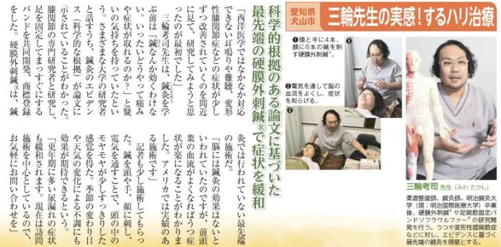 超旋刺と臨床のツボ―鍼灸問わずがたり | 首藤 傳明, ヨシダ ケン