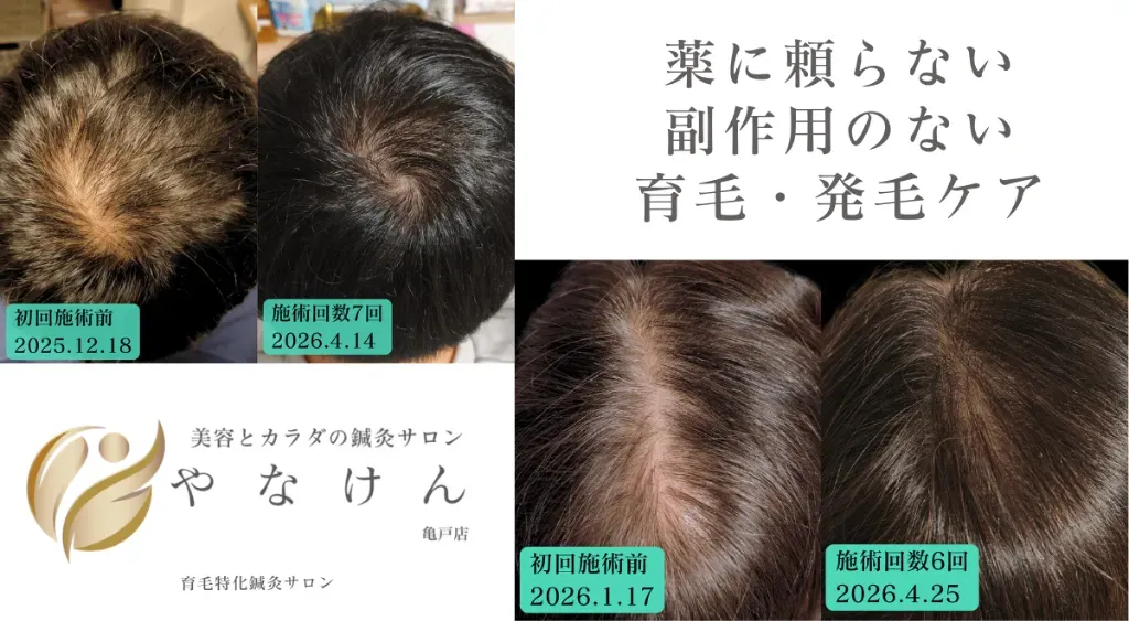 美容とカラダの鍼灸サロン やなけん 亀戸店 院詳細 | 両国・錦糸町