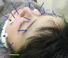 しょう鍼灸整骨院