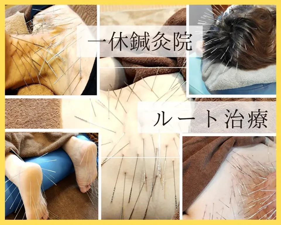 一休鍼灸院 ルート治療専門院